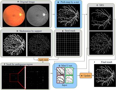 Dynamic Deep Networks for Retinal Vessel Segmentation